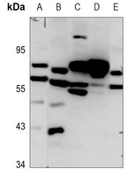 FZD8 antibody