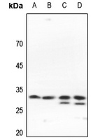 SLC25A11 antibody