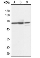 Anti-KLF11 Antibody