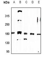 Anti-MRCK alpha Antibody