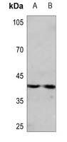 Anti-CDK10 Antibody