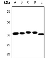 Anti-PRPF18 Antibody