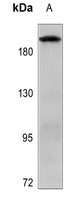 Anti-MADD Antibody