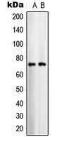 SLC25A12 antibody