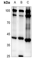Anti-RPC Antibody