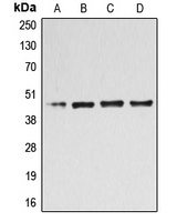 Anti-B4GALT3 Antibody