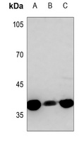 Anti-B3GALT1 Antibody