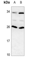 Anti-RAIDD Antibody