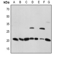 Anti-CD256 Antibody