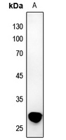 TNFSF12 antibody