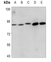 Anti-ADAM23 Antibody
