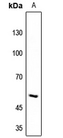 Anti-RIOK3 Antibody