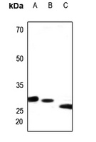 Anti-PEX11B Antibody