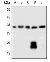 SOCS2 antibody