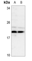 Anti-TSC22 Antibody