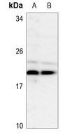 TSC22D1 antibody