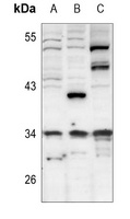 Anti-CDK5R1 p35 Antibody
