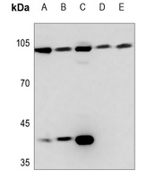 Anti-Topoisomerase 3 beta1 Antibody