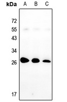 Anti-Nop30 Antibody