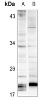 Anti-SOCS3 Antibody
