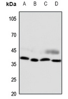 CCRL2 antibody