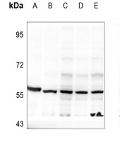 DOK2 (phospho-Y299) antibody