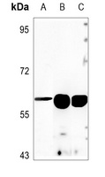 Anti-ANGPTL1 Antibody