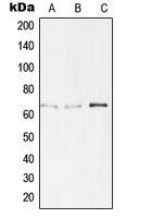 Anti-TBX15/18 Antibody