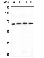 Anti-TBX18 Antibody