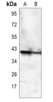 FCGR2C antibody