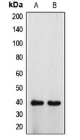 ATP6V0D1 antibody