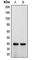 Anti-ATP6V0D1 Antibody