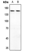 MYOM2 antibody