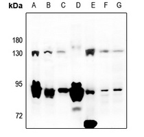 MAP3K13 antibody