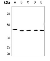 Anti-BUB3 Antibody