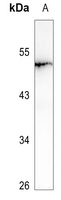 Anti-LRAT Antibody