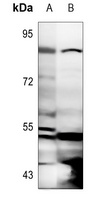 Anti-MSK1 (Phospho-T581) Antibody