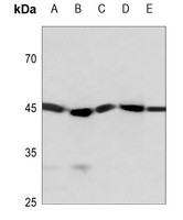 Anti-STK17B Antibody