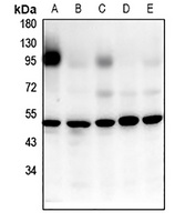 Anti-GPR52 Antibody