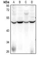 Anti-SFRS11 Antibody