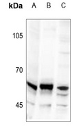 Anti-TRIP13 Antibody