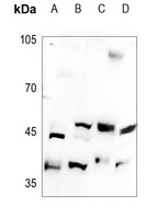 Anti-B4GALT5 Antibody