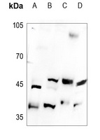 B4GALT5 antibody