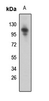 Anti-SNRP116 Antibody