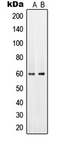 SLC22A6 antibody