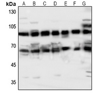Anti-ABCG2 Antibody