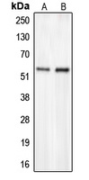 Anti-CHST2 Antibody