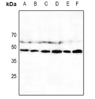 NKp46 antibody