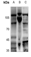 Anti-ADAMTS2 Antibody