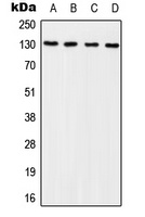 Anti-p130 Cas (Phospho-Y249) Antibody